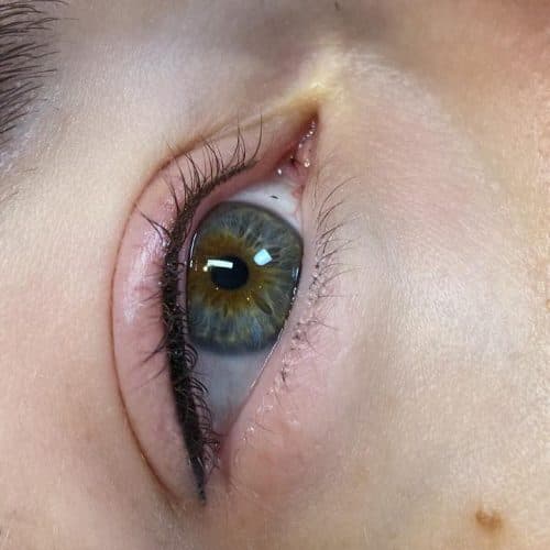 Lash Enhancement