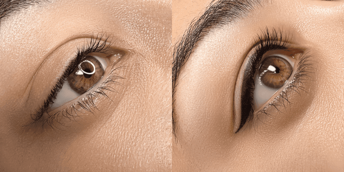 8 Best Eyebrow Treatments: Which Is Right For You?