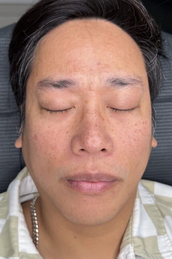 Before