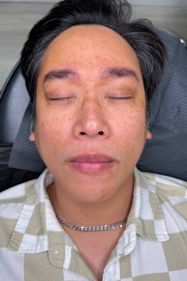 After