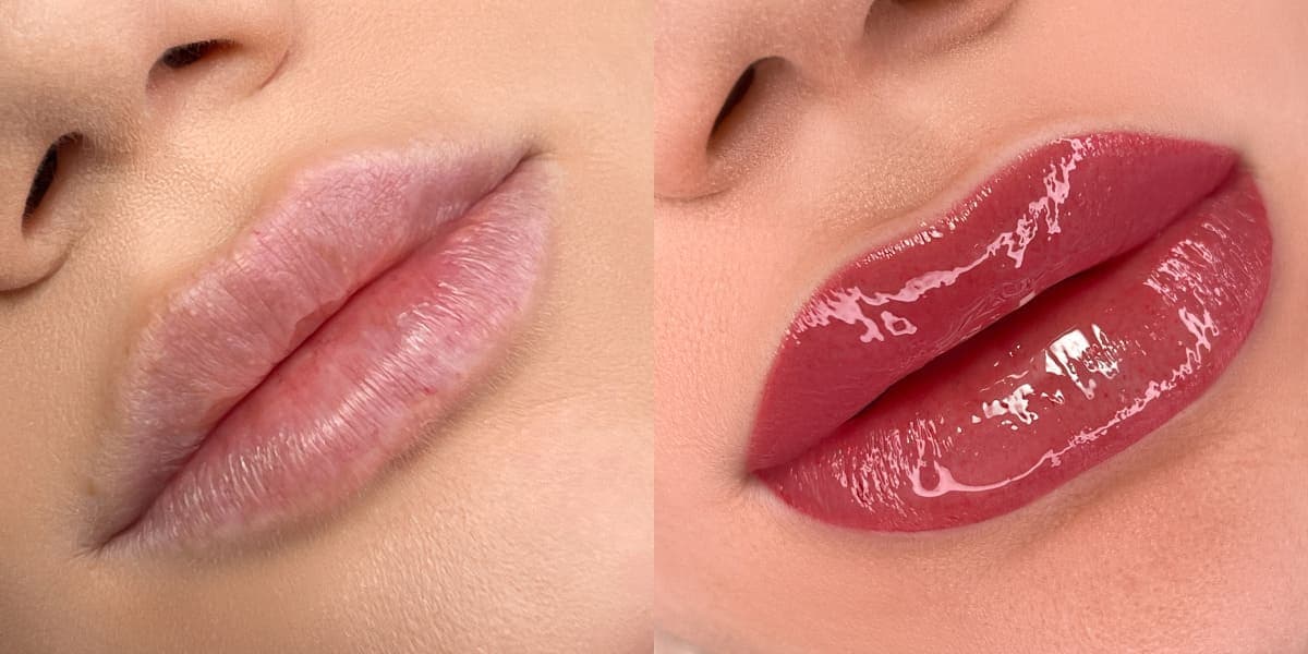 Full lips