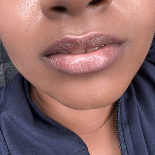 Lip Neutralization 2