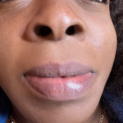 Lip Neutralization 4