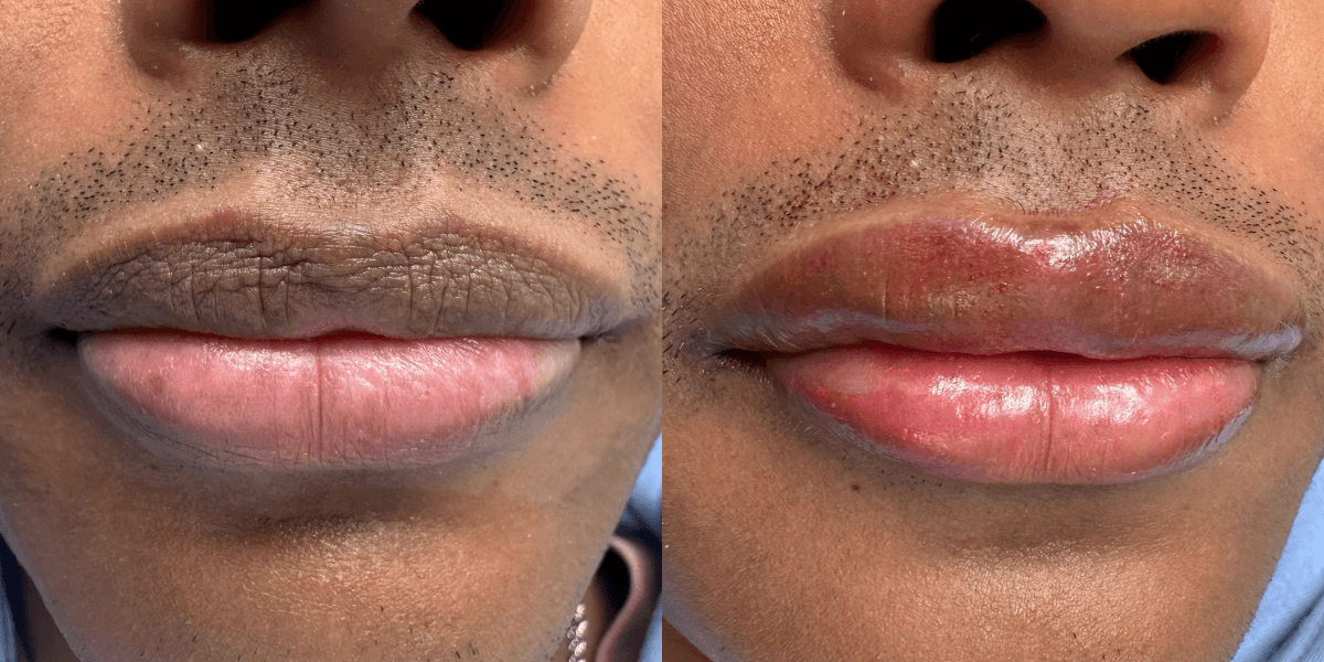 Lip Blushing For Men