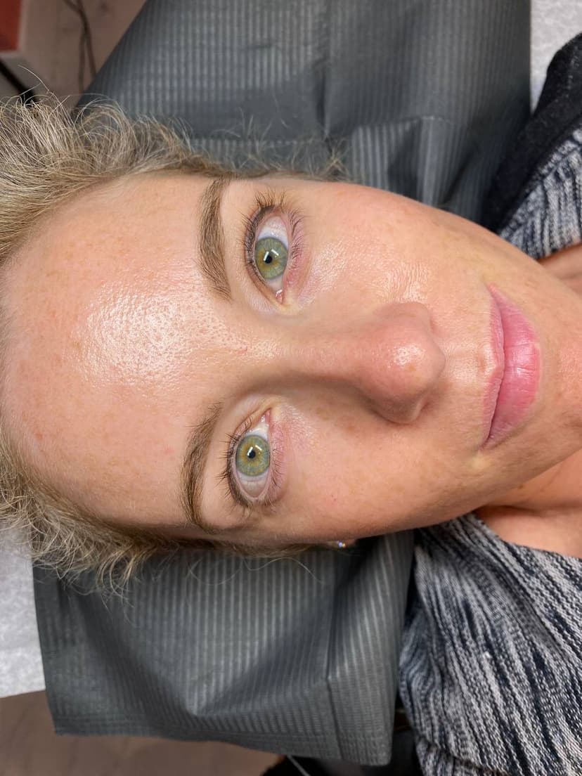 Procedure photo