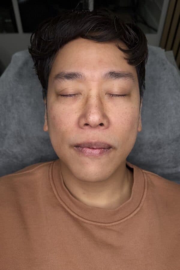 Procedure photo