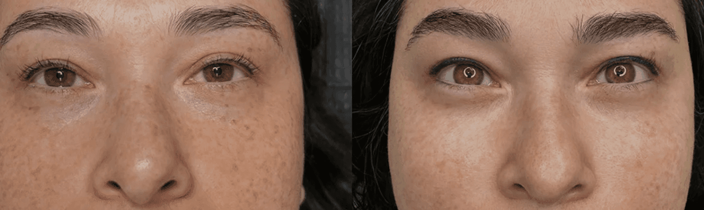 Permanent Brows San Jose