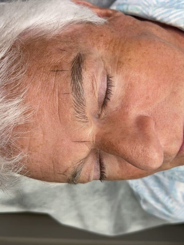 Procedure photo
