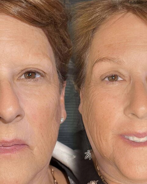 Permanent makeup before and after by Anna Kara, San Diego