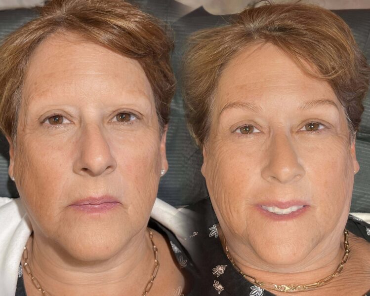 Permanent makeup before and after by Anna Kara, San Diego