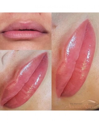 Lips procedure before and after, Anna Kara PMU