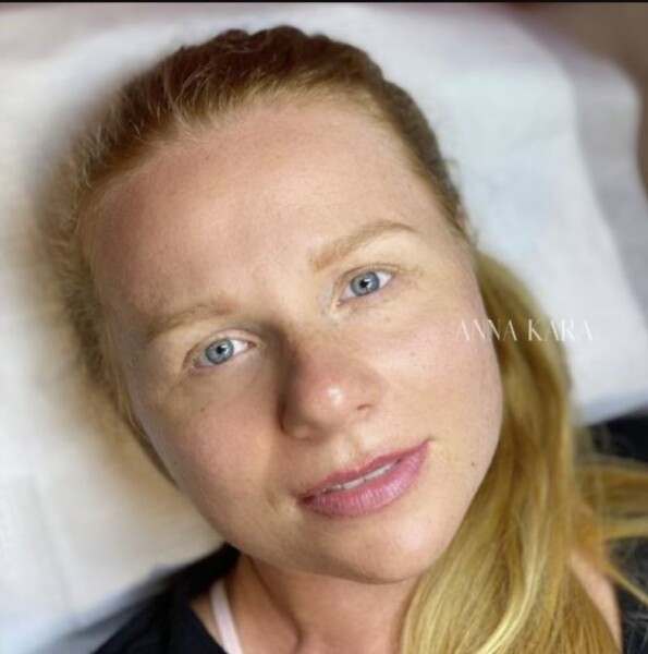 Permanent makeup before and after by Anna Kara, San Diego
