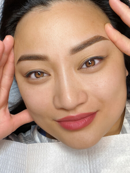 Microneedling, Anna Kara PMU