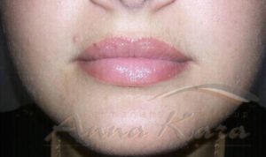 lips natural look permanent makeup