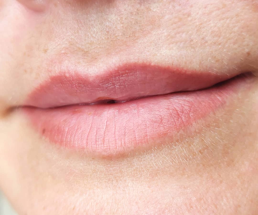 permanent lips- natural procedure