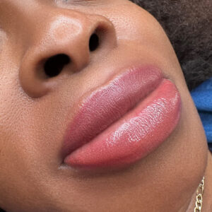 Lip Neutralization 3