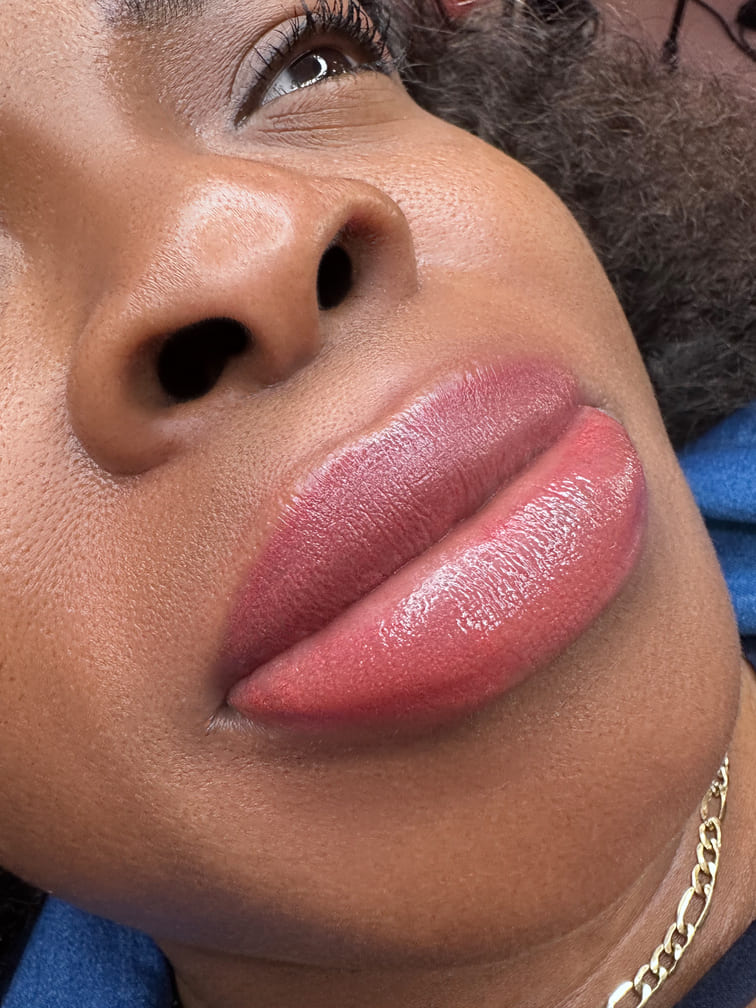 Lip Neutralization 3