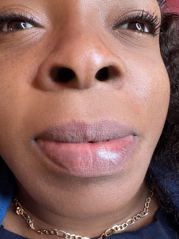 Lip Neutralization 4