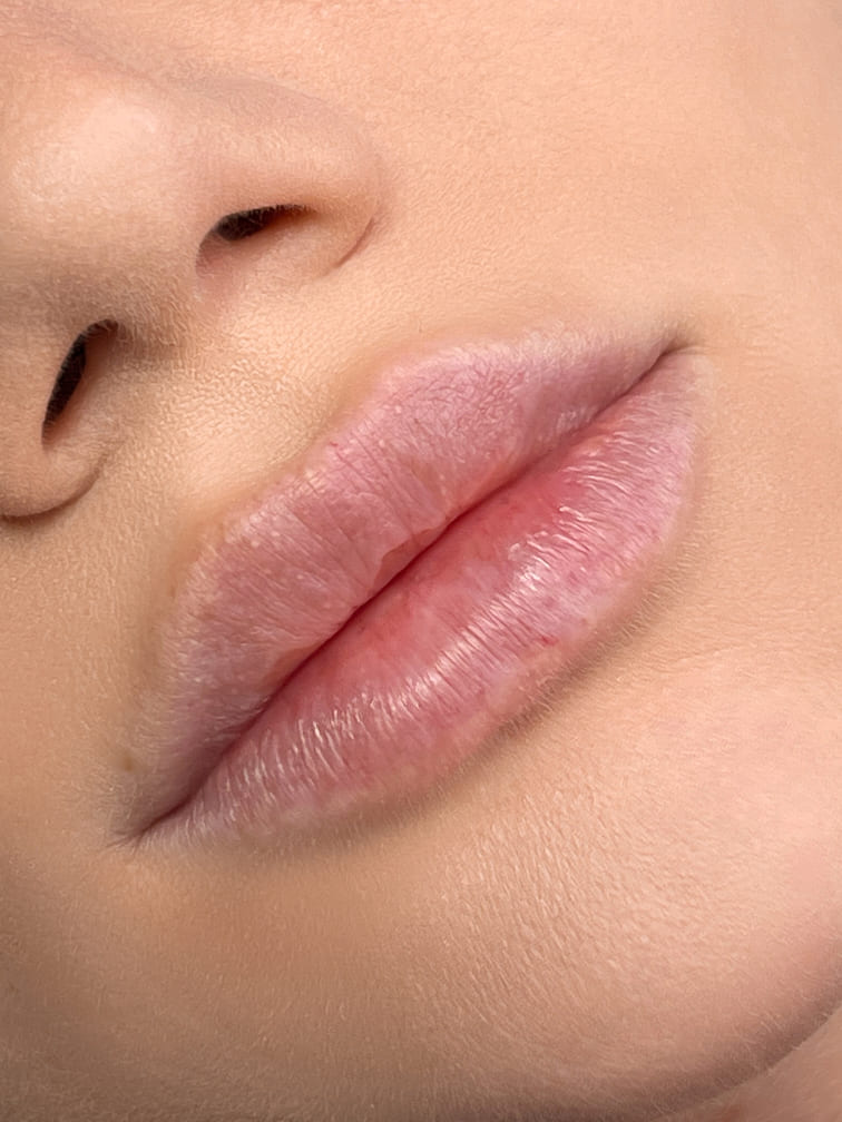 Natural Full Lips 4
