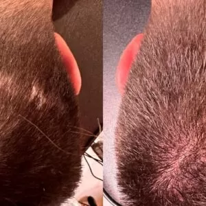 Scalp Micropigmentation San Diego