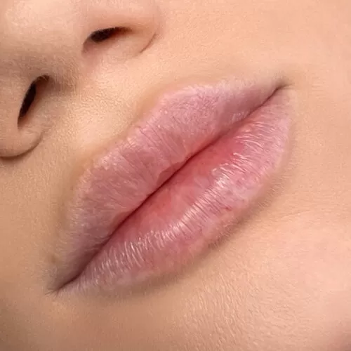 Natural Full Lips 4