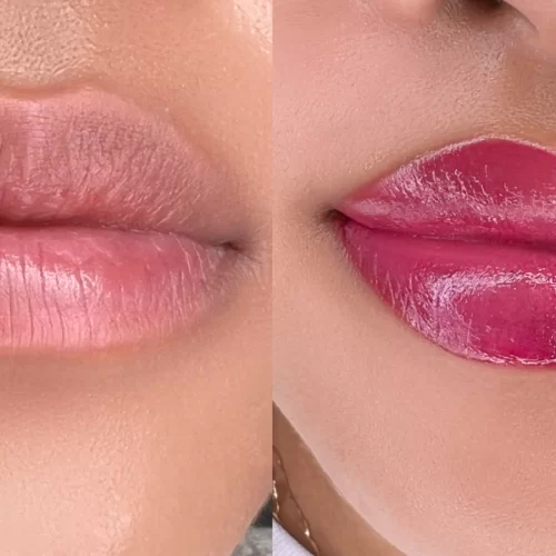lips 2 1913834